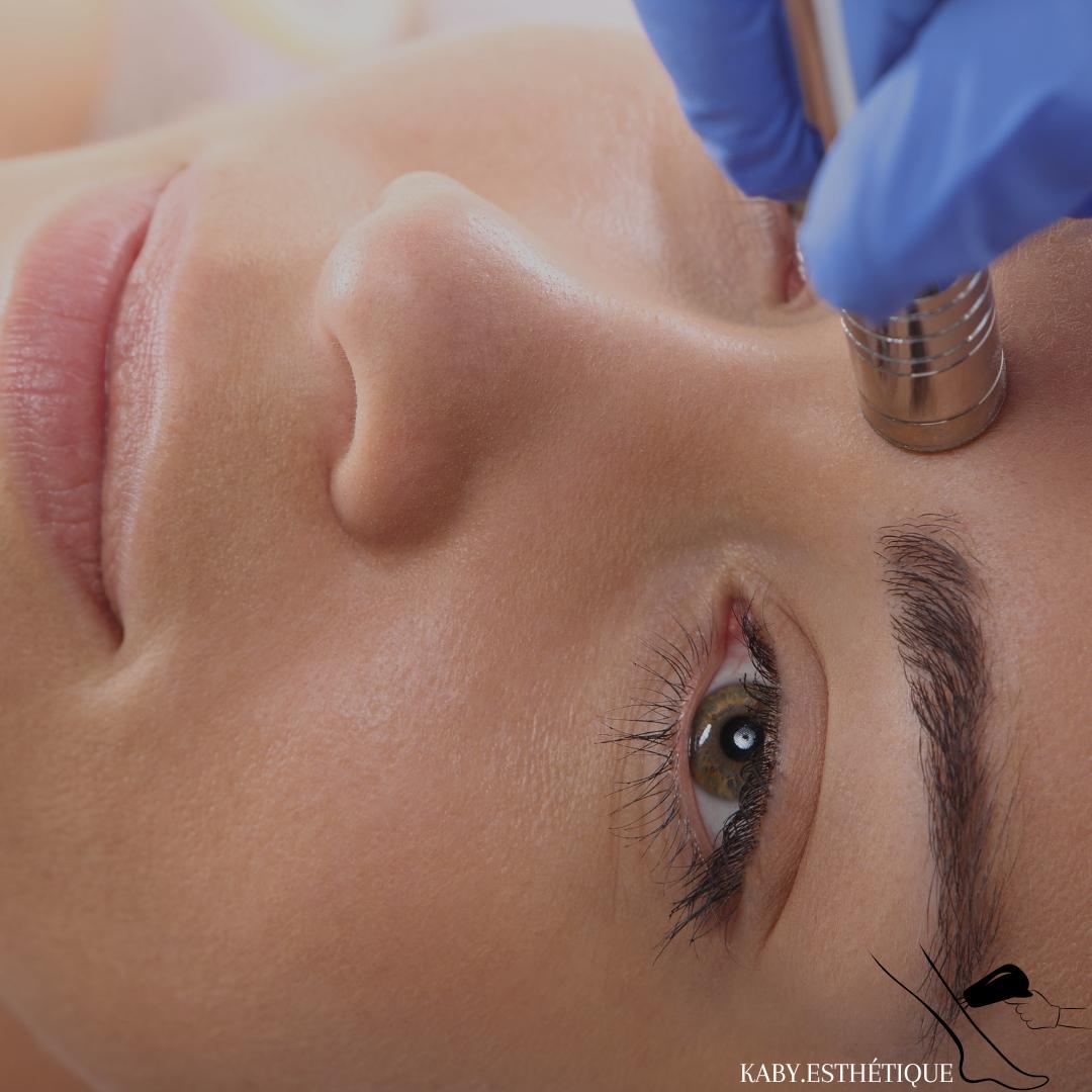Facial de Base + Microdermabrasion