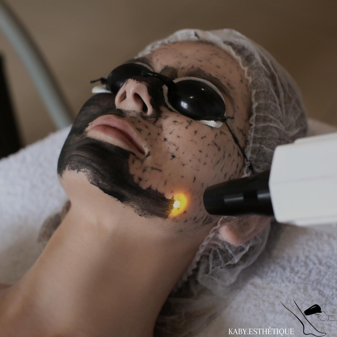 Peeling (Multitask)